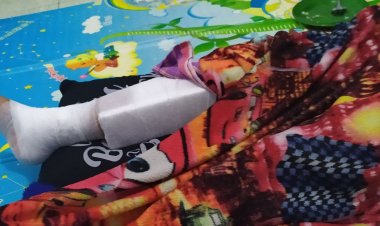 Korban yang tertimpa Baliho Salah Satu Calon Bupati  Ratu - Najib diberikan biaya pengobatan untuk kesembuhan